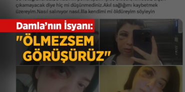 Sokakta Tacize Uğradı, Dövüldü, Şimdi Evine Mahkûm