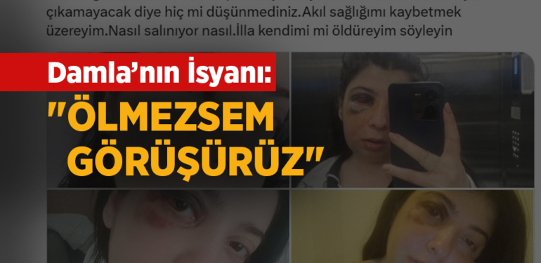 Sokakta Tacize Uğradı, Dövüldü, Şimdi Evine Mahkûm