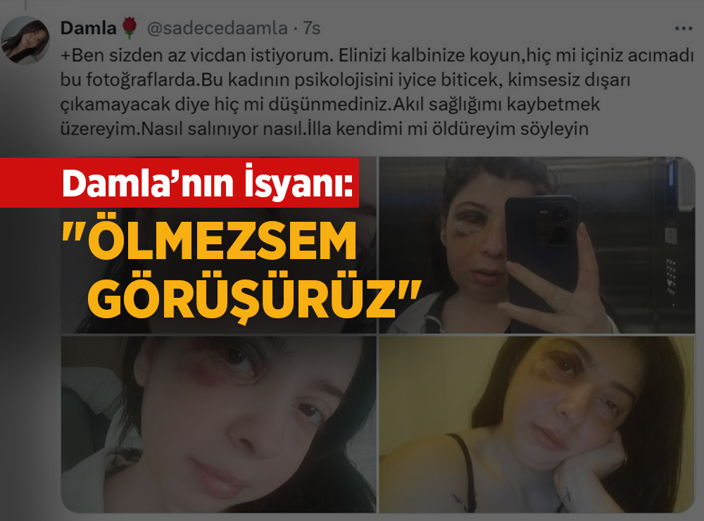 Sokakta Tacize Uğradı, Dövüldü, Şimdi Evine Mahkûm